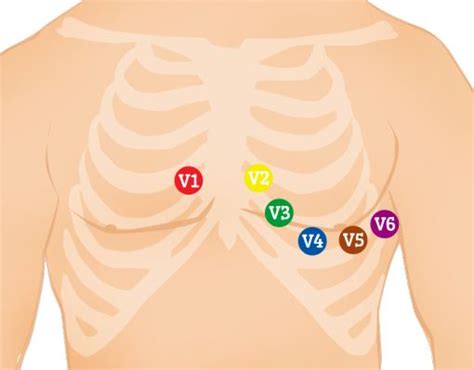 12-Lead ECG Placement Guide with | Paramedic student, Emt study ...