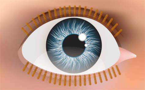 Meibomian Gland Dysfunction: Causes, Symptoms, and Treatments