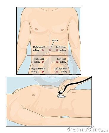 Abdominal Auscultation Stock Illustration - Image: 58972776