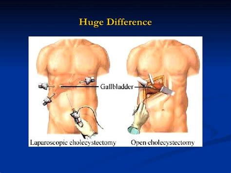 Laparoscopy: Historic, Present and Emerging Trends