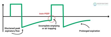 Auto-PEEP: Complication of Mechanical Ventilation (2023)