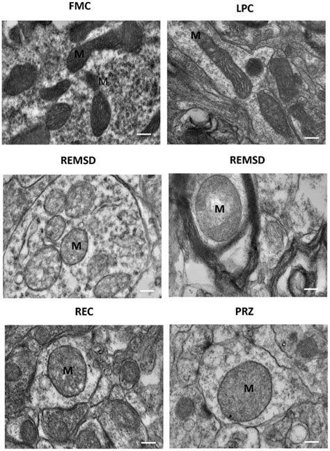 Frontiers | Rapid Eye Movement Sleep Deprivation Induces Neuronal Apoptosis by Noradrenaline ...