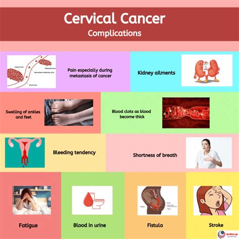 Cervical Cancer Complications