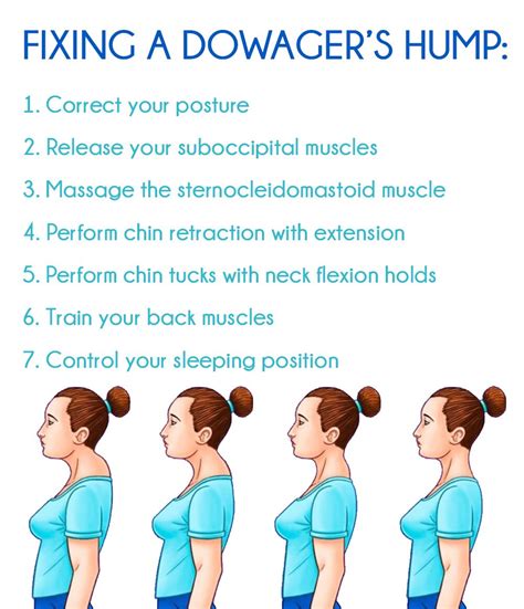 Dowager's Hump Fix: Avoid a Dowager's Hump - Granny Health Today ...