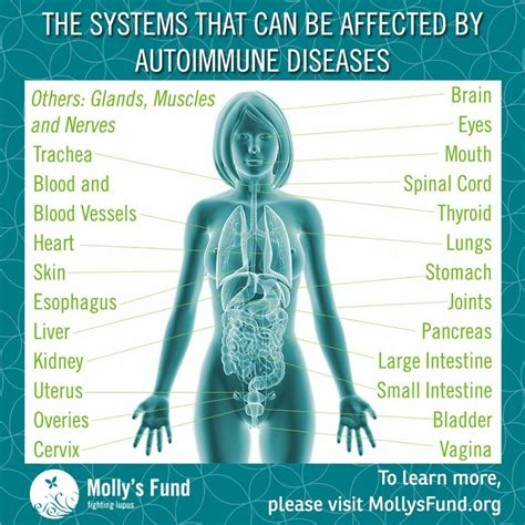 Understanding #Autoimmune Diseases: What You Need to Know. Definition, Causes, Symptoms, Who is ...