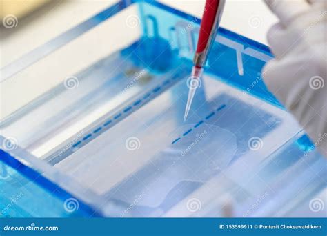 Molecular Technique Gel Electrophoresis For DNA Sample Method Decrypt The Genetic Code Stock ...