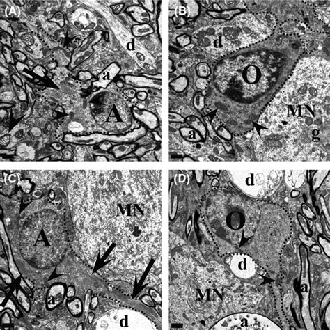 Glia cells do not exhibit cytoplasmic abnormalities. (A and B) At P30,... | Download Scientific ...