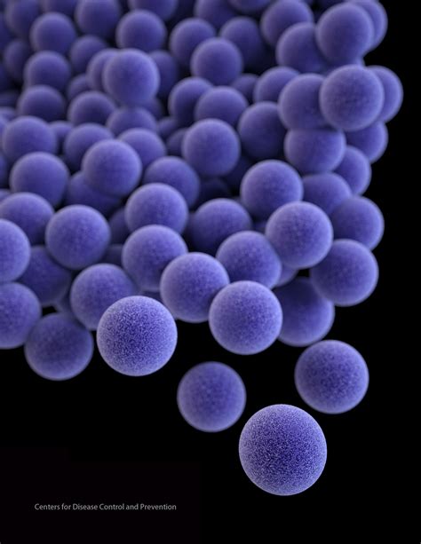 Staphylococcus aureus