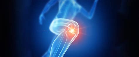 Knee Ligament Surgery - ACL Reconstruction- Medicana Health Group