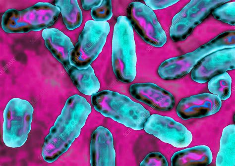 Pseudomonas aeruginosa - Stock Image - C012/9506 - Science Photo Library