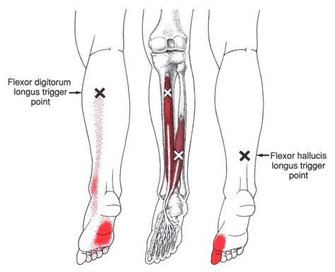 Pin auf Knee Issues And Leg Work.