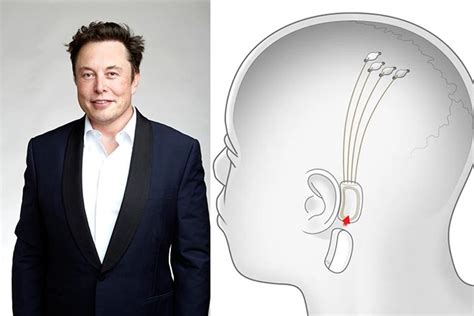 Elon Musk is developing a brain chip to stream music inside your head ...