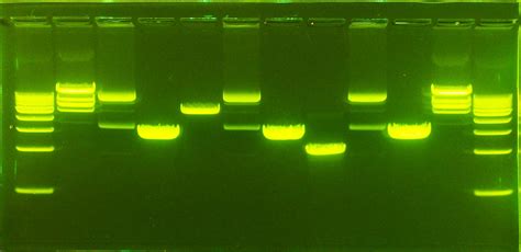 Gel Electrophoresis - DNA - GelGreen | Dna art, Gel, Science