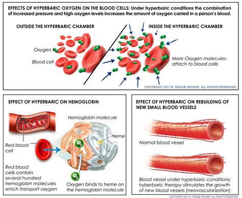 Hyperbaric Oxygen Therapy - Utah Body and Soul