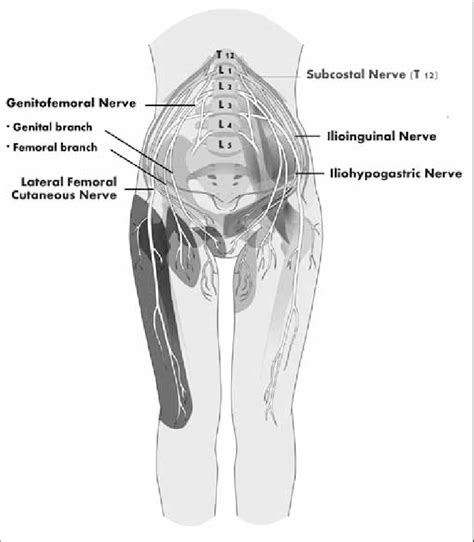 Iliohypogastric Nerve Pain