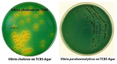 Thiosulfate-Citrate-Bile Salts-Sucrose (TCBS) Agar- All You Need to Know