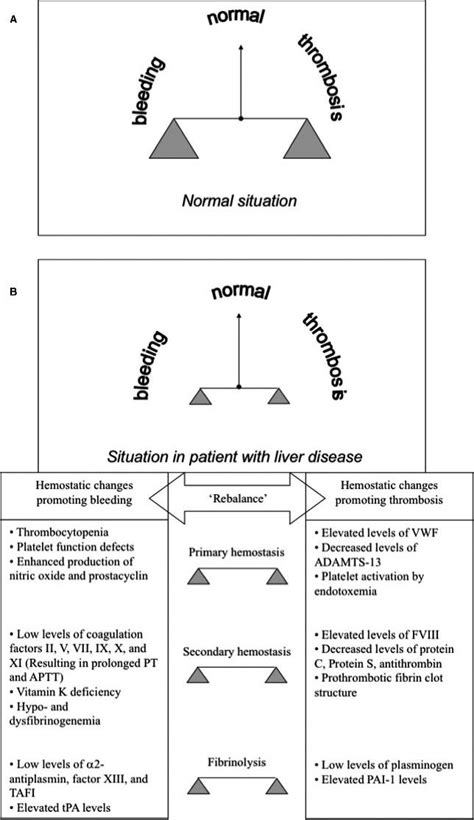 Deranged hepatic synthesis and rebalancing of pro, anti-coagulant and... | Download Scientific ...