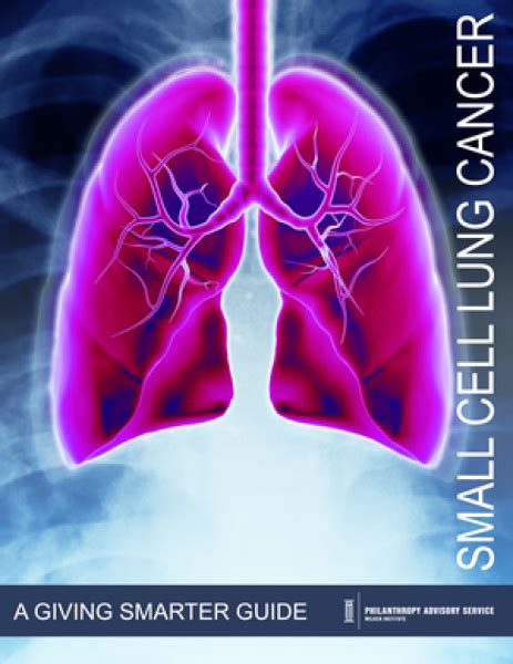 Small Cell Lung Cancer - A Giving Smarter Guide | Milken Institute