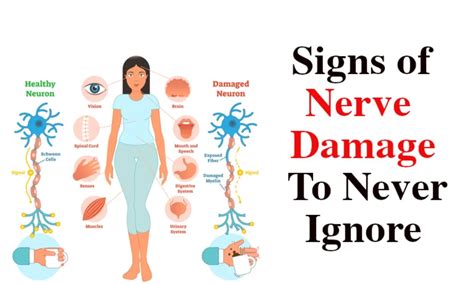 What are the symptoms of nerve damage? - FITPAA