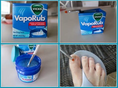 Diskriminieren Nuklear Ring vaporub en los pies Kapitalismus bedingungslos stumm