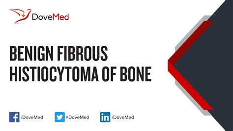 Benign Fibrous Histiocytoma of Bone