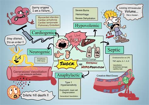 Hypovolemic Shock Stages