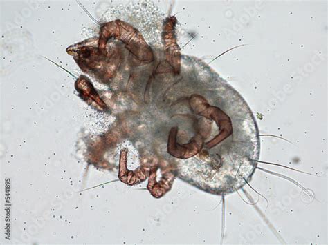 "dust mite under microscope" Stock photo and royalty-free images on Fotolia.com - Pic 5441895