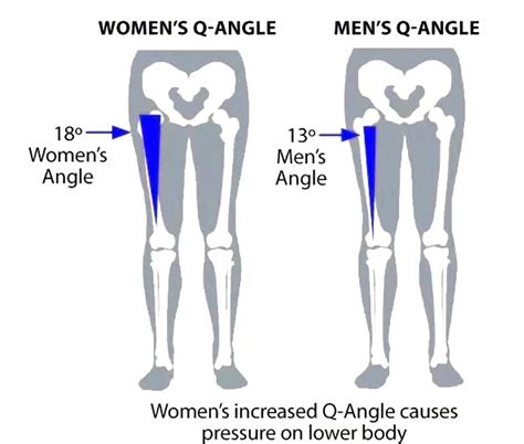 Q/Quadriceps Angle Knee Injuries In Women Athletes