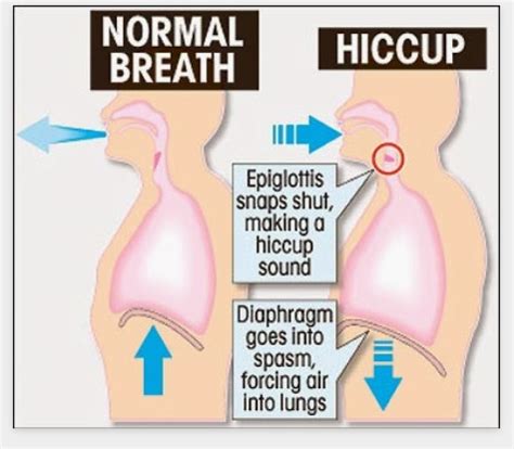 Interesting Facts about Hiccups | Interesting Facts