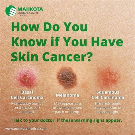 GLOWING SKIN, GLOWING HEALTH: BATTLING THE SHADOWS OF SKIN CANCER | by ...