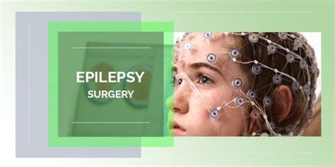 Epilepsy Surgery - Boston Brain and Spine Care | Best Neurosurgeon In Chennai