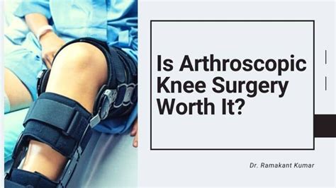 Is Arthroscopic Knee Surgery Worth It? | Arthroscopic knee surgery, Knee surgery, Knee surgery ...