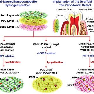 An example of hydrogels used for periodontium regeneration studies.... | Download Scientific Diagram