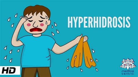 Hyperhidrosis, Causes, Signs and Symptoms, Diagnosis and Treatment. - YouTube