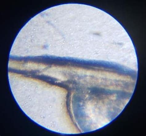 Cementum attaching egg to hair shaft under a microscope. Photo taken by ...