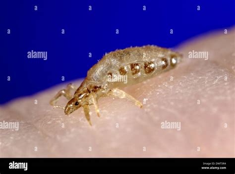 Body louse Stock Photo - Alamy