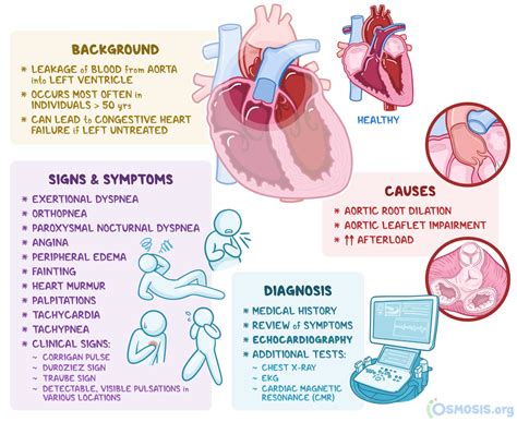 Aortic Regurgitation: What Is It, Causes, Diagnosis, Treatment, and ...