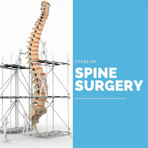 Types Of Spine Surgery | New Jersey | Comprehensive Spine Care