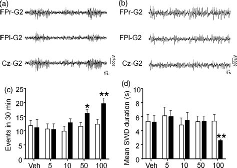 GABAB receptor activation exacerbates spontaneous spike-and-wave discharges in DBA/2J mice ...