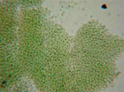 Microcystis aeruginosa - microbewiki