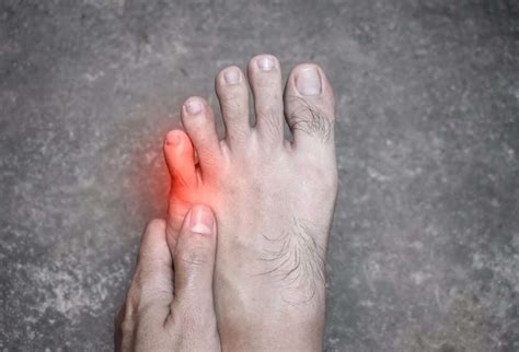 6 Important Sprained Toe Symptoms You Must Know