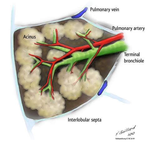 Secondary pulmonary lobule (illustration) | Radiology Case ...