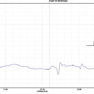 (PDF) The elecrophysiological bulbocavernosus reflex test in female dogs: Its technique and ...