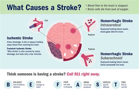 What Causes a Stroke? How Different Types of Strokes Happen