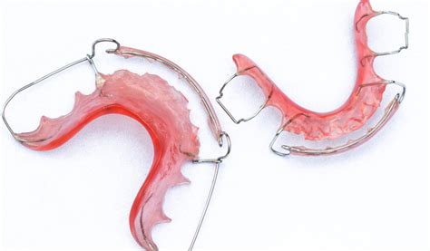 Coping With a Broken Retainer - Orthodontic Blog | Orthodontic ...