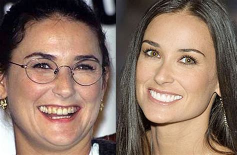 Demi Moore’s Plastic Surgery Helped Her Keep Her Youthful Appearance ...