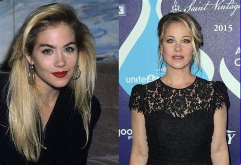 Christina Applegate Plastic Surgery Before And After Photos