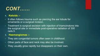 TUMORS OF EAR | PPT | Free Download