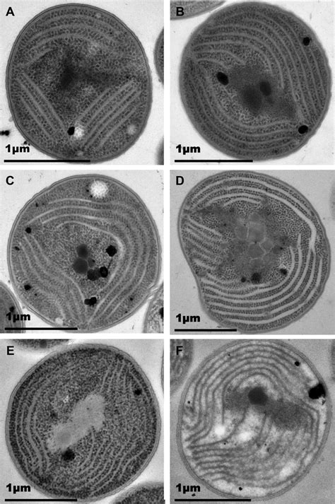 TEM of Synechocystis wild-type and mutant cells. Electron micrographs ...