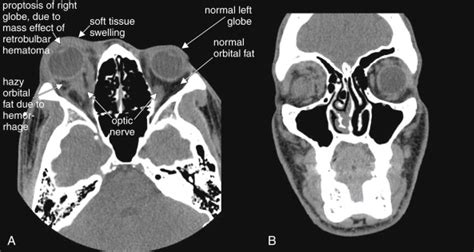 Imaging the Face | Radiology Key